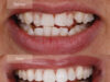 Aetna Dental Insurance: How Much Does It Cost Per Month? Aetna Dental Providers