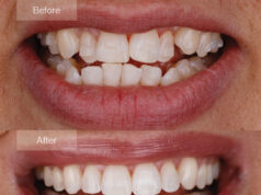 Aetna Dental Insurance: How Much Does It Cost Per Month? Aetna Dental Providers