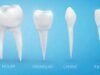 A Tooth Number Chart: Understanding the Different Parts of Your Teeth tooth number chart