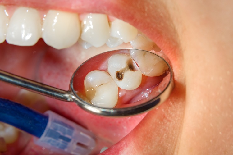 Dental Problems You Should Know About